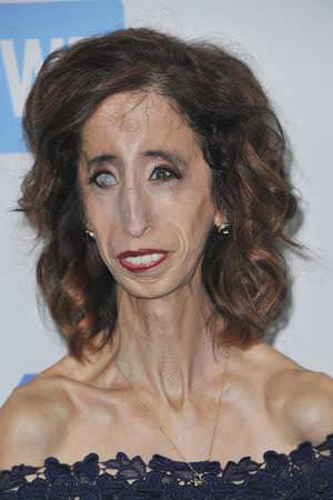 Lizzie Velasquez